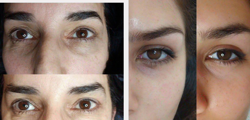 💉 Camuflaje de Ojeras - Yess Lacroix Academy