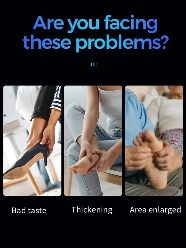 Laser Treatment for Nail Fungus - Restore Healthy Nails Fast