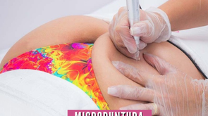 🌈 Micropuntura Brasileña - Yess Lacroix - TR3ndyFB